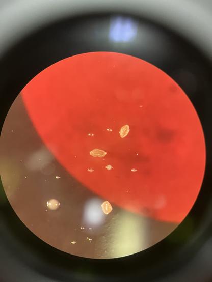 Photo taken from microscope of little raised, translucent yellowish bacteria colonies.