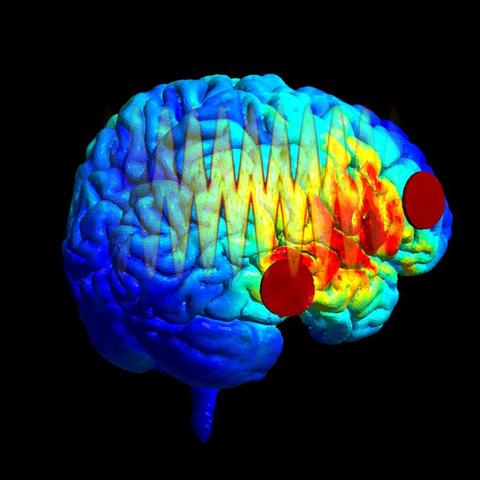 The image shows the distribution of the electric field, simulated in SimNIBS, on the reconstructed brain of a healthy human participant. Red circles show the position of the electrodes on the right hemisphere. Overlaid is a spectrogram of one of the auditory stimuli used in the study. Image Credit: Yuranny Cabral-Calderin