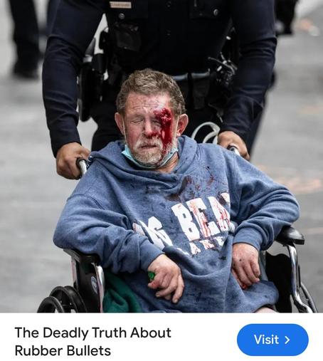 https://www.forbes.com/sites/davidhambling/2020/06/08/the-deadly-truth-behind-rubber-bullets/