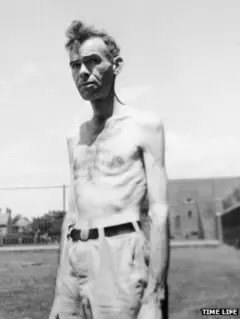 Human subject from the Minnesota Starvation Project