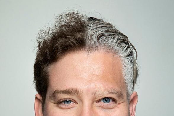 Photo of a man from the nose up. Half of his hair is brown and the other half is grey.