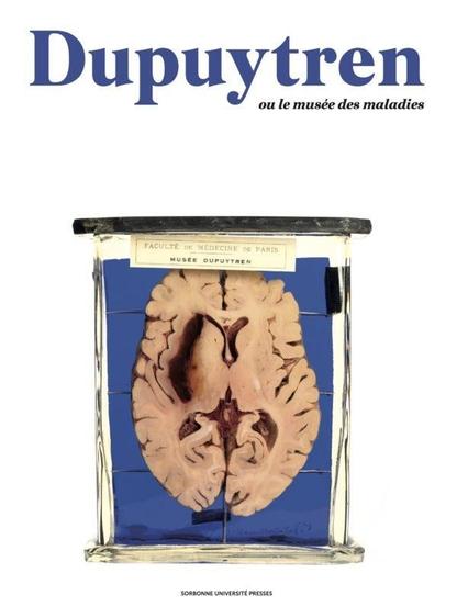 Couverture d'ouvrage illustrée par un cerveau dans un bocal