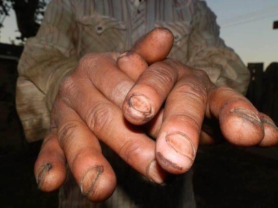 A photo of a farm worker's worn hands.