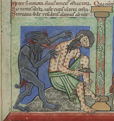 Leprosy existed in the Americas long before European contact, new study reveals

For centuries, it was the conventional narrative that leprosy, also known as Hansen’s disease, was introduced into the Americas by European colonists or enslaved Africans. But a groundbreaking new study published in Science is now overturning that assumption. According to an international team of researchers, a lesser-known bacterial species, Mycobacterium lepromatosis, existed across the Americas at least 1,000 years before European contact, rewriting our understanding of the disease’s global history...