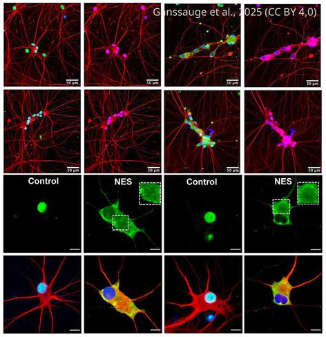 A Human iPSC-based model of TDP43 proteinopathy in MNs
