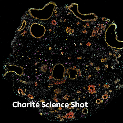 Auf schwarzem Hintergrund ist ein rundes Konstrukt zu erkennen, das mit zahlreichen Löchern aussieht wie eine Kraterlandschaft. Einzelne Zellen dieses Gewebeverbandes leuchten Gold oder Orange. © Charité | Susanna Quach