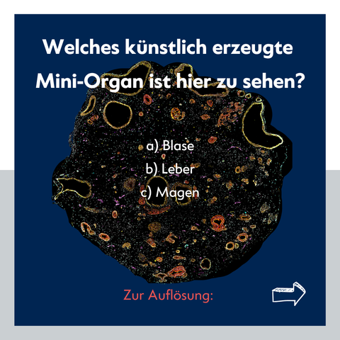 Textfolie: "Welches künstlich erzeugte Mini-Organ ist hier zu sehen? a) Blase b) Leber c) Magen. Zur Auflösung" [Pfeil nach rechts]