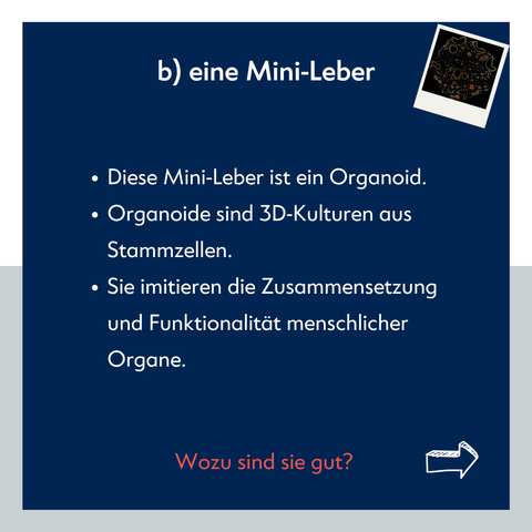 Textfolie: "b) eine Mini-Leber. Diese Mini-Leber ist ein Organoid. Organoide sind 3D-Kulturen aus Stammzellen. Sie imitieren die Zusammensetzung und Funktionalität menschlicher Organe. Wozu sind sie gut?" [Pfeil nach rechts]
