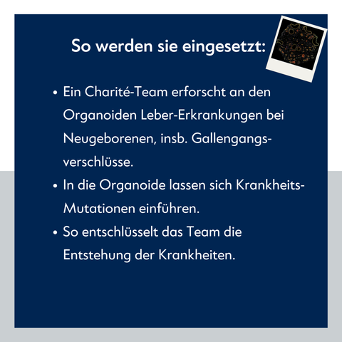 Textfolie: "So werden sie eingesetzt: Ein Charité-Team erforscht an den Organoiden Leber-Erkrankungen bei Neugeborenen, insb. Gallengangsverschlüsse. In die Organoide lassen sich Krankheits- Mutationen einführen. So entschlüsselt das Team die Entstehung der Krankheiten."
