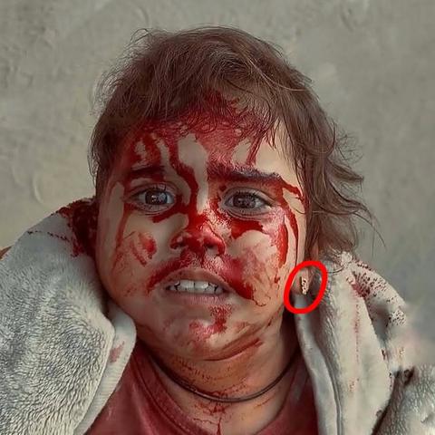 A terrified and injured Palestinian child with her face covered in blood, looking straight at the camera with wide, panicked eyes. She's wearing a small earring that reads “Love,” a haunting contrast to the brutal reality she's facing.