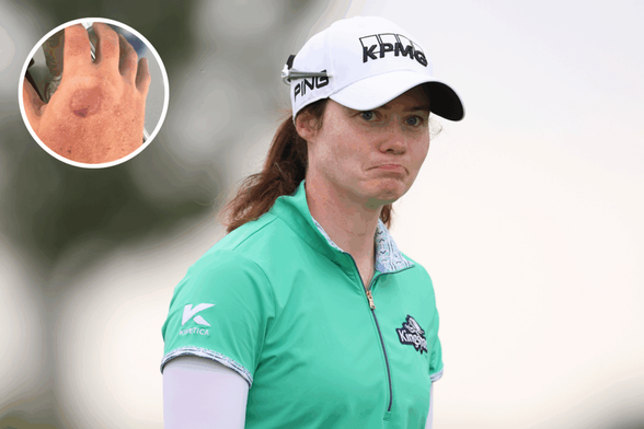 FRISCO, TEXAS - JUNE 18: Leona Maguire
