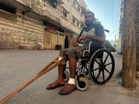 Ahmed Nejm wurde am 11. Juni bei einem israelischen Angriff auf eine Hilfsgüterverteilungsstelle in Wadi Gaza verletzt. (Foto: Hamza Salha)