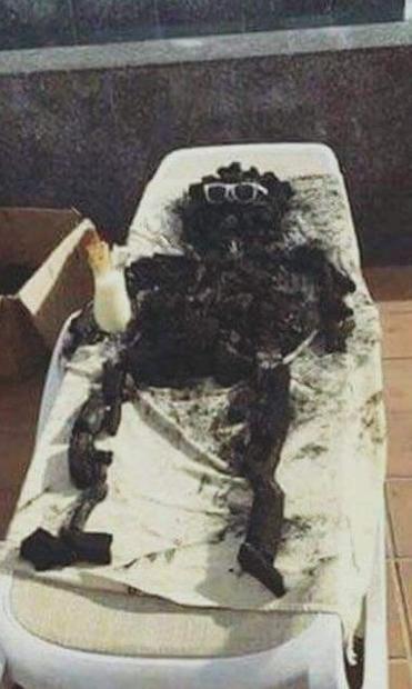 Une personne calcinée sur une chaise longue avec un pina colada dans la main.