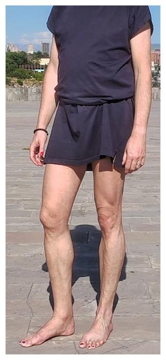 Das Bild zeigt eine Person, die barfuß auf einem steinernen Platz im Freien steht. Die Person trägt ein kurzes, dunkelblaues Kleid mit einem Stoffgürtel in der Taille. Die Kleidung hat kurze Ärmel und reicht etwa bis zur Mitte der Oberschenkel. Die Person hat lackierte Fuß- und Fingernägel in einem roten Farbton und trägt ein schwarzes Armband am linken Handgelenk sowie einen Ring an der rechten Hand.