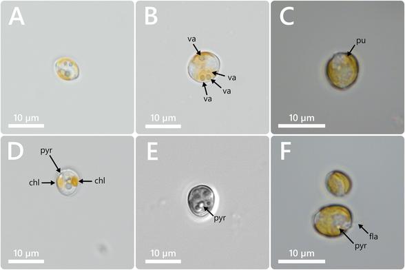 microscopic photos of single-celled algae
