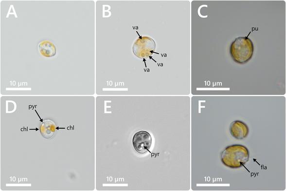 microscopic photos of single-celled algae