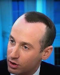 A photograph of Stephen Miller with spray-on hair particles forming a widow's peak on the top of his head.