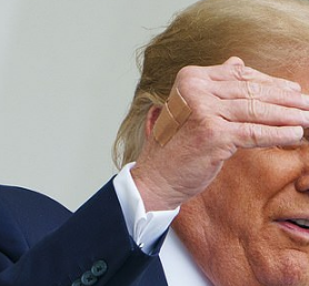 Trump wound care top of hand