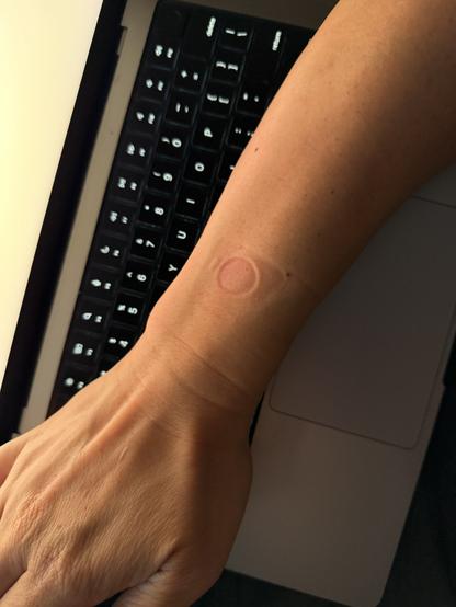 A wrist with a dent in it.