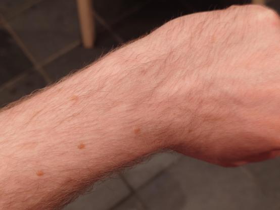 A photo of Matt's wrist, adorned by nothing.