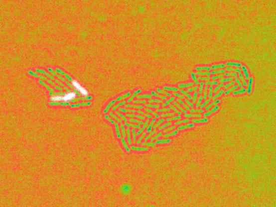 Zellen von Pseudomonas aeruginosa in Falschfarben (grün) dargestellt, einzelne Zellen sind weiß gefärbt
