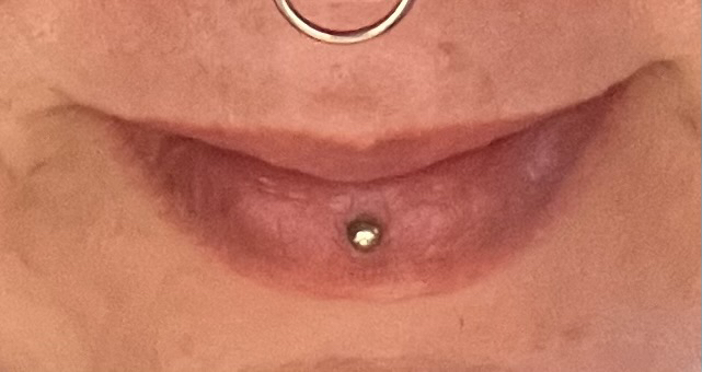 Nahaufnahme eines lächelnden Mundes mit Septum- und Ashley-Piercing.