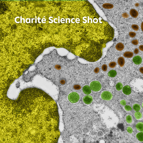 Man sieht eine mikroskopische Aufnahme einer Zelle. In Gelb ist der Zellkern links im Anschnitt erkennbar, seine Form erinnert an ein Maul. Rechts daneben ist der Rest der Zelle in Grau zu sehen. Grüne und braune runde Kreise in diesem Bereich stellen die Viruspartikel dar. © Charité | Carsten Dittmayer