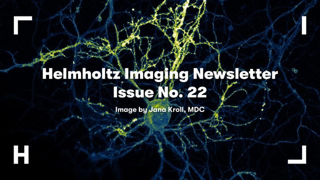 Visual to promote the Helmholtz Imaging Newsletter No. 22, image by Jana Kroll from MDC