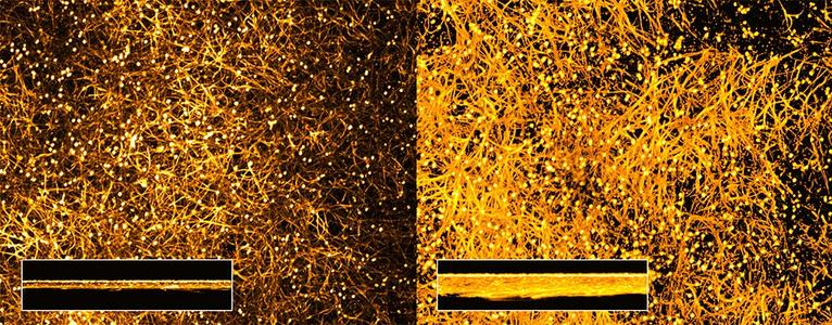 A comparison of two photos of Candida albicans shows that a denser biofilm is formed in the presence of human albumin (right) than in its absence (left). In the photos, the yeast cells were colored in a golden hue.