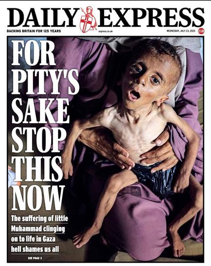 DAILY BACKING BRITAIN FOR 125 YEARS FOR PITY'S SAKE STOP THIS NOW The suffering of little Muhammad clinging on to life in Gaza hell shames us all SEE PAGE 3 EXPRESS express.co.uk WEDNESDAY, JULY 23, 2025 €1.80

Starving child