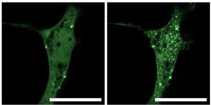 Cells expressing Yap (stained green). Left side without condensate induction, right side two minutes after condensate induction, now filled with green dots.