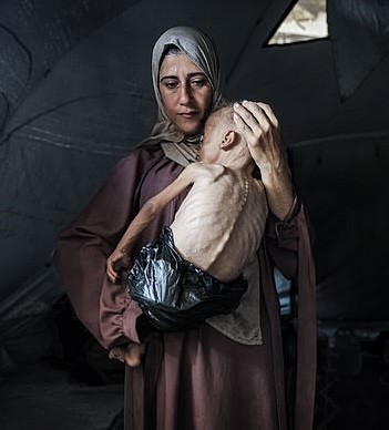Starving child in Gaza