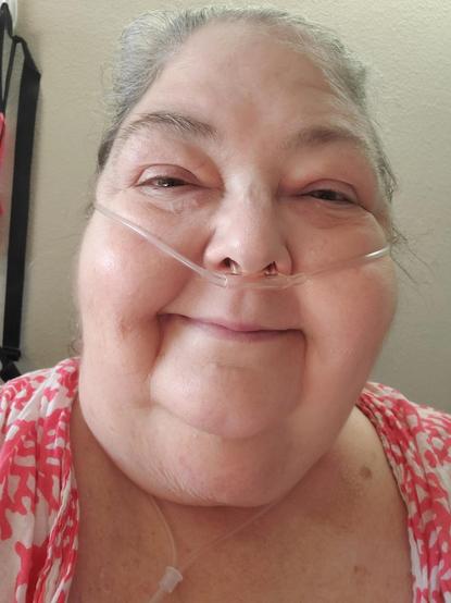 Me - a middle aged woman with blond hair pulled back, a pink and white cotton shawl around shoulders, oxygen canula in nose, I am smiling at camera