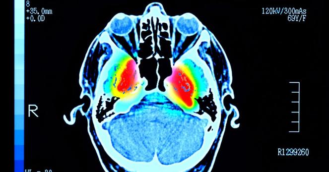 Japan’s Pharma Leader Seeking Approval for New Parkinson’s Treatment