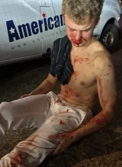 That idiot kid, "Big Balls" sitting on the ground with nose blood all over him