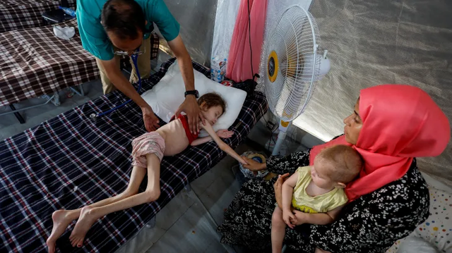 This was the most difficult picture that I have ever had to add Alt Text to.

It is a picture of a young child that is dying from starvation. Her ribs can be counted, her ankle is so thin that it can be surrounded by a hand.

She is lying on a cot with a plaid blanket. A man is holding the child's arm and appears to be checking on her.

Next to her, on the right side of the image, a woman wearing a red headscarf is sitting and holding a baby on her lap.