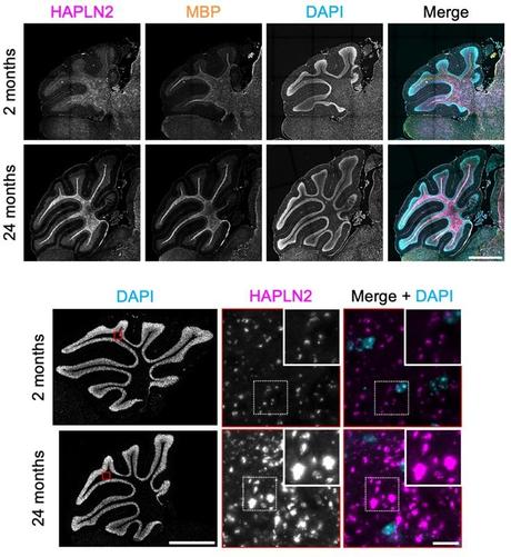 HAPLN2 forms aggregate-like structures in the cerebellar white matter of aged mice. Top: Representative images of fluorescence immunohistochemistry of the mouse cerebellum showing HAPLN2, myelin basic protein (MBP, a marker for myelinated axons), and 4′,6-diamidino-2-phenylindole (DAPI). n = 3. Bottom: Magnified fluorescence immunohistochemistry images for HAPLN2 corresponding to the boxed areas in the left panels. n = 3.