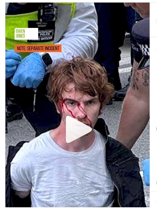 A young man who has blood streaming from his head, pictured at the #PalestineAction  demo, sat March 6th In the background, there are the bloodied knuckles of a police officer.