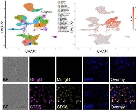 Human CTSZ variants are associated with TB severity, and CTSZ is present at the host-pathogen interface within human pulmonary Mtb granulomas. Top left: A manually annotated UMAP generated by unsupervised clustering of data from single-cell mRNA-Seq of human biopsy tissue, containing Mtb granulomas from three patients with TB. Top right: Analysis of normalized expression values reveals that CTSZ is specifically induced in granuloma macrophages, particularly in lipid-associated macrophages. Bottom: Brightfield (BF) images and immunofluorescent staining of CTSZ and CD68 within a granuloma biopsy from an individual with pulmonary TB. Goat (Gt) and mouse (Ms) IgG isotype control staining is depicted in the top row. DAPI staining indicates cell nuclei. Scale bar is 60 µM in length.