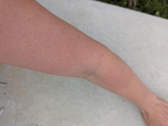 Mon bras, on voit la marque de mon gant de soudage au milieu de l'avant bras