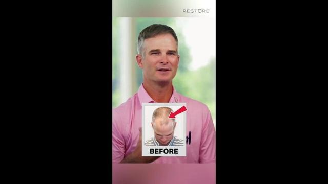 PGA Golfer Kevin Streelman Shares His Restore Hair Story ⛳✨ | FUE Hair Transplant