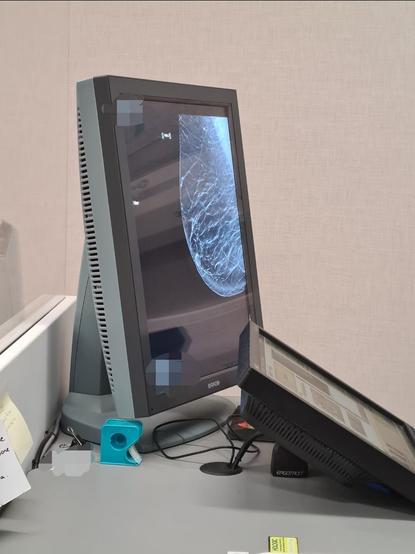 The screen showing my mammogram, a faintly boob shaped grey shape with stripes of lighter grey through it.