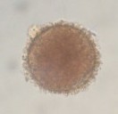 image/jpeg a microscope photograph shows a spherical orange egg with a spiky surface. Calanoid diapause egg.