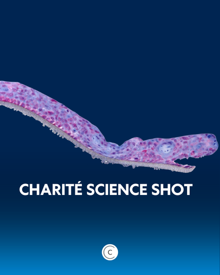 Ein Gewebe, das dem langen Hals und dem Kopf einer Schlange ähnelt (freigestellt vor blauem Hintergrund). Der "Kopf" hat das Maul geöffnet und man erkennt eine Art Auge. Foto: Charité | Anja Kühl