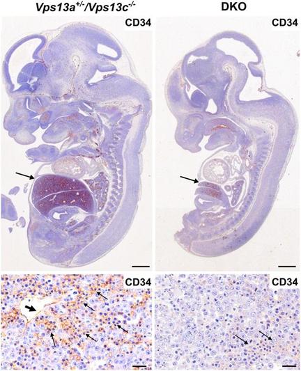 Gross fetal pathology and histology of E12.5 DKO embryos and controls. All controls are KO for Vps13c and WT or heterozygous for Vps13a KO. Top: H&E stained longitudinal section of control (left) and DKO (right) fetuses processed for anti-CD34 immunohistochemistry. The DKO liver is much smaller (arrows) with reduced CD34 immunoreactivity (bottom) where the CD34 immunoreactivity on vascular endothelia (thick arrow, bottom left) and hematopoietic precursors (thin arrows) is shown in brown.