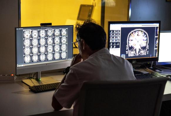 Un sanitario revisa los resultados de un escáner cerebral en la sede de la Fundación Pasqual Maragall.