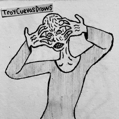 A bald wrinkled man with the skin of his fingers melded onto his head