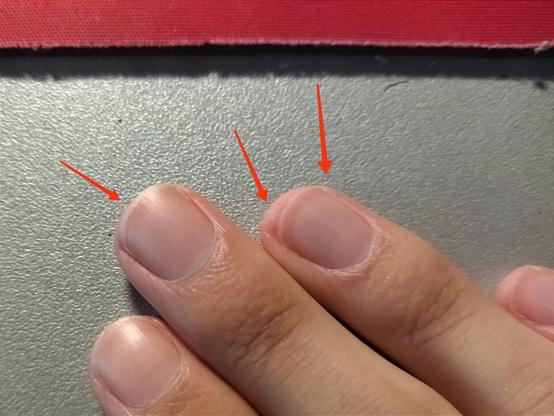 Alcune mie unghie sulla mano destra (quindi tagliate con la sinistra), con frecce ad indicare i dettagli schifosi come descritto