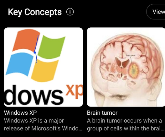 YouTube's key concepts section on a video, showing first "windows xp", then "brain tumor", both with images and a cut off description of what they are (there's a blue blob on windows xp because i fat fingered my phone when screenshotting it, oops)