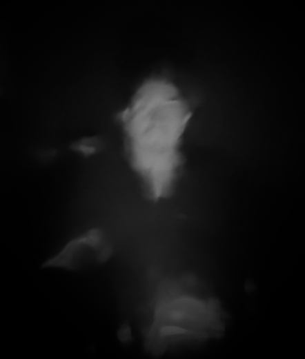 A heavily distorted and blurry photo of myself looking at the camera. Everything is in black and white and there seems to be a slight glow around my head. My left eye is so distorted that you cannot see it.